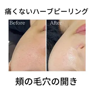 N eye beauty 高丘店所属・N  eye beauty高丘のエステ・リラクイメージ