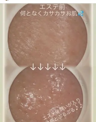 メナード熊本 嘉島のエステ・リラクイメージ