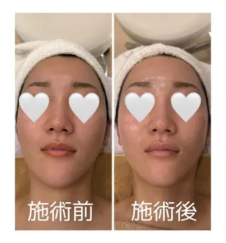 メナードフェイシャルサロン丸の内ヒルズ所属・メナード丸の内ヒルズ 柳田りさのエステ・リラクイメージ