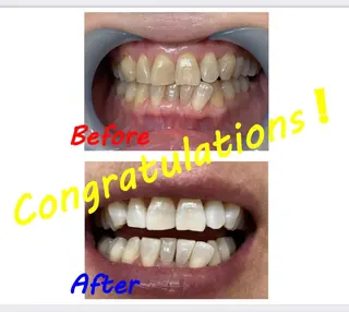 セルフホワイトニングサロン　ラヴィアン所属・ホワイトニングサロン La vie enのその他イメージ