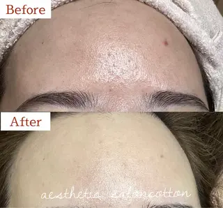 都度払い 肌質改善専門サロンのエステ・リラクイメージ