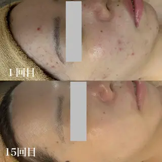 WHITE AQUA 北千住店のエステ・リラクイメージ