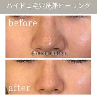 肌質改善エステ chiffonのエステ・リラクイメージ