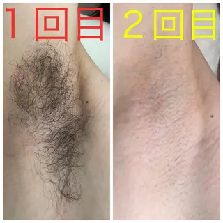 ﾄｰﾀﾙｽｷﾝｹｱ美容Room所属・トータルスキンケア 美容Roomのエステ・リラクイメージ