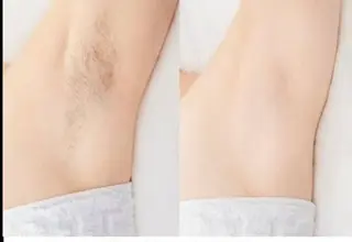 女性専用脱毛サロン エンジェルナンバーのエステ・リラクイメージ