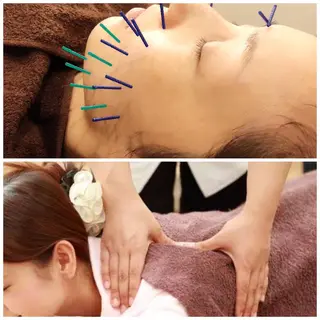美容鍼灸女性専用 りんご鍼灸治療院のその他イメージ