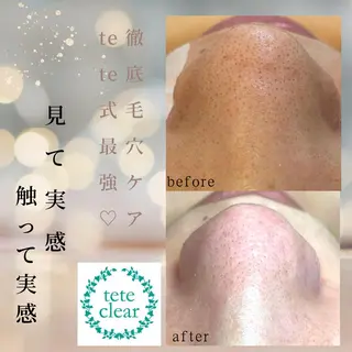 セルフエステエンリケ明石大久保店所属・夕希リンパ&痩身& 脱毛&毛穴ケアのエステ・リラクイメージ