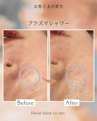 La chic. 加古川のエステ・リラクイメージ