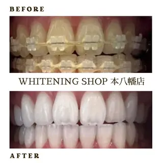 メンズ ホワイトニング ショップ本八幡店のエステ・リラクイメージ