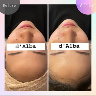 ニキビ改善専門店 d'Albaのエステ・リラクイメージ