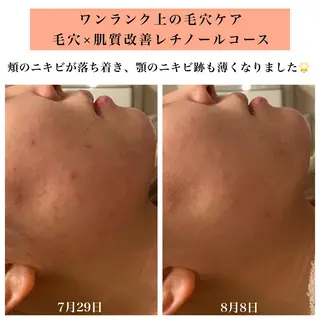 Bellesthe (ベルエステ)のエステ・リラクイメージ