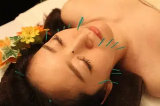 小顔矯正・美容鍼 美鍼堂のエステ・リラクイメージ