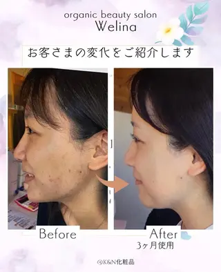 Welina所属・Welina (ウェリナ)のエステ・リラクイメージ