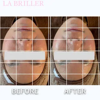 LA BRILLERのエステ・リラクイメージ
