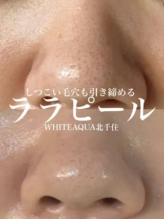 WHITE AQUA 北千住店のエステ・リラクイメージ