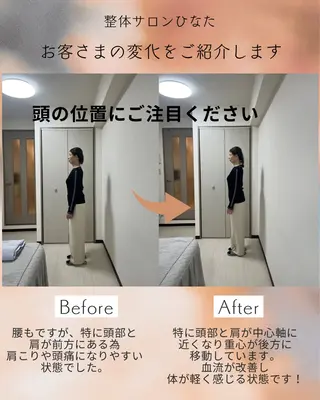 整体サロン　ひなた~HINATA~ 　京阪七条　京都店所属・肩こり反り腰改善専門 筋膜✨整体ひなたのエステ・リラクイメージ