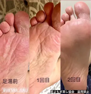 private salon Dea_maris シュガーリング&パーソナルボディケア所属・シミ改善・韓国肌管理 ボディメイク痩身のその他イメージ