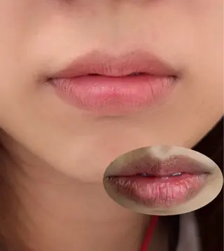 小顔/たるみ/黒ずみ除去専門サロン/SONA 大和西大寺店所属・【小顔専門看護師 サロンSONA】のエステ・リラクイメージ