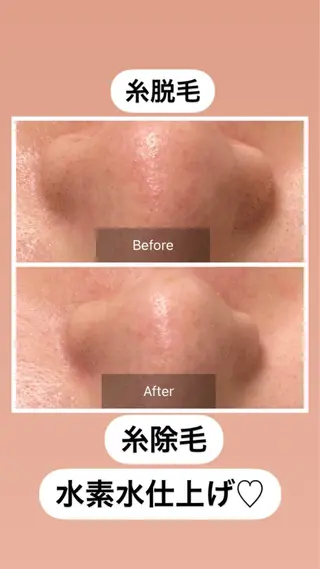 産毛専門店 Bittoのエステ・リラクイメージ