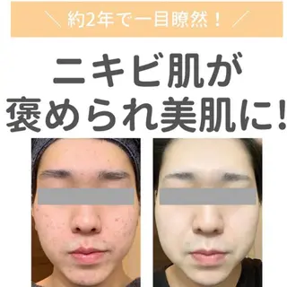 顧問医師提携サロン ENSOLEILLEのエステ・リラクイメージ