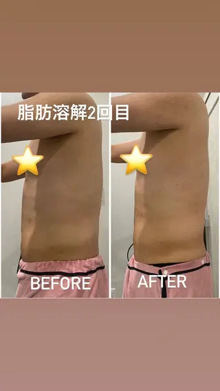 毛穴洗浄・痩身・脱毛 /アルカンジュのエステ・リラクイメージ