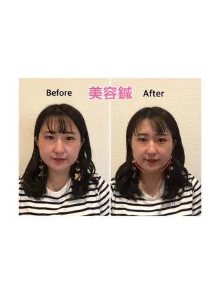 チキバン美容鍼灸整体 サロン心斎橋店のエステ・リラクイメージ