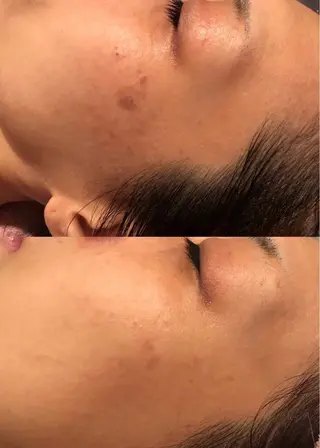 エステサロン lindyのエステ・リラクイメージ