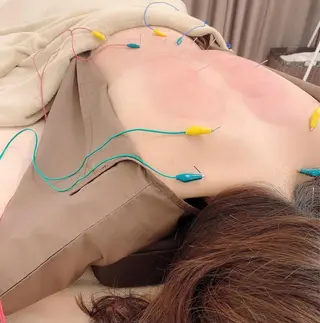 新宿hari-me所属・美容鍼hari-me 新宿のエステ・リラクイメージ