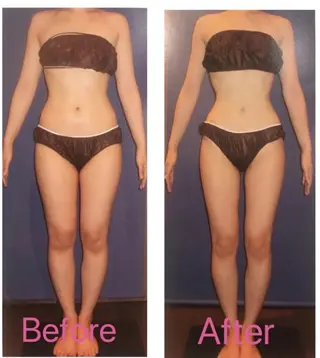 BELINDA銀座店 ✨痩身エステサロン✨のエステ・リラクイメージ