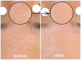 韓国肌管理 【毛穴専科】のエステ・リラクイメージ