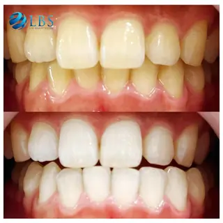 LBSホワイトニング 銀座店💎スタッフ峯のその他イメージ