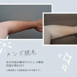 メンズ ホワイトニングサロン プレジールのエステ・リラクイメージ