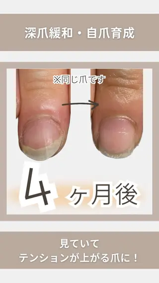 ネイル KIKOA NAIL キコアネイルのネイルデザイン