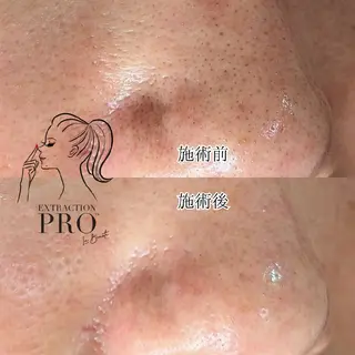  毛穴洗浄・まつ毛 の専門店 ソラーレのエステ・リラクイメージ