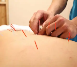 小顔ハーブピーリング 美容鍼/毛穴洗浄のエステ・リラクイメージ