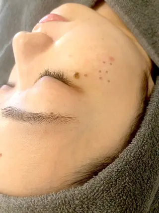 シミケア専門店 &More所属・シミケア専門店 &Moreのエステ・リラクイメージ