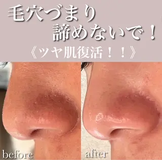 Luana  アイラッシュ& フェイシャル所属・Luana eyelashのマツエク・マツパデザイン