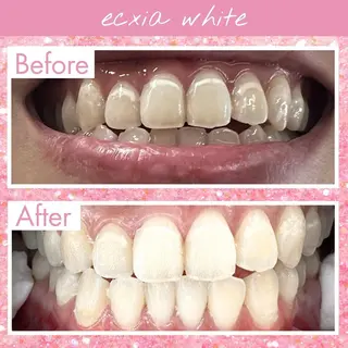 セルフホワイトニング エクシア福島のその他イメージ