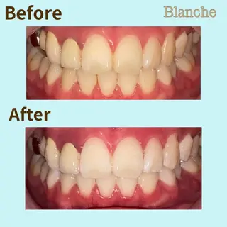 BLANCHE所属・Blanche 心斎橋のその他イメージ