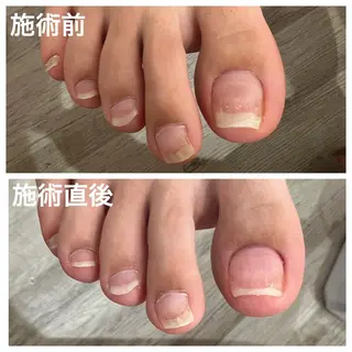 ネイル S Mihoのネイルデザイン