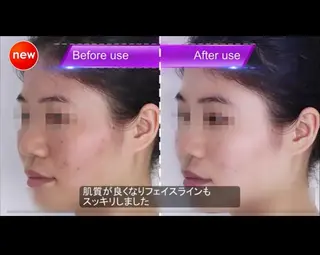 FLEUR大阪・美容 整体・痩身・小顔のエステ・リラクイメージ