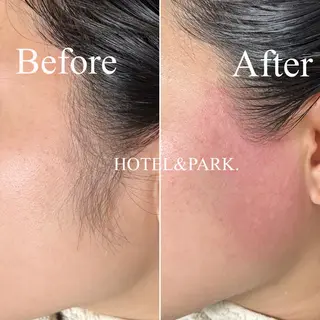 HOTEL&PARK . ワックス脱毛のエステ・リラクイメージ