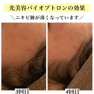 Bellesthe (ベルエステ)のエステ・リラクイメージ