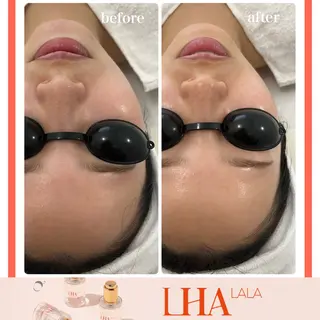 Liam《美肌管理/ 3D小顔/脂肪ケア》のその他イメージ