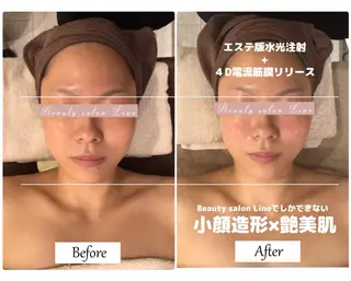 痩身×フェイシャル ブライダル|Linoのエステ・リラクイメージ