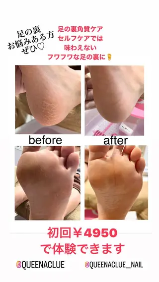 ネイル 毛穴改善/脱毛 ネイル 川上久仁子のエステ・リラクイメージ