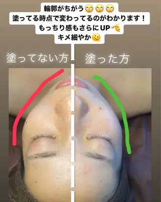 肌育脱毛サロン LikoLinaのその他イメージ