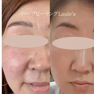 痩身/腸もみ/ ヘッドスパ/リンパのエステ・リラクイメージ