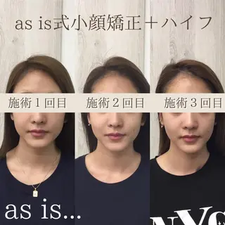 小顔専門アズイズ ビューティー　草津店のエステ・リラクイメージ