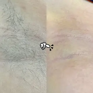 Hit. シュガーリング豊橋のエステ・リラクイメージ